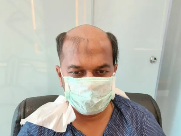 Client-12 - Before