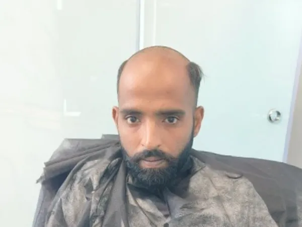Client-17 - Before