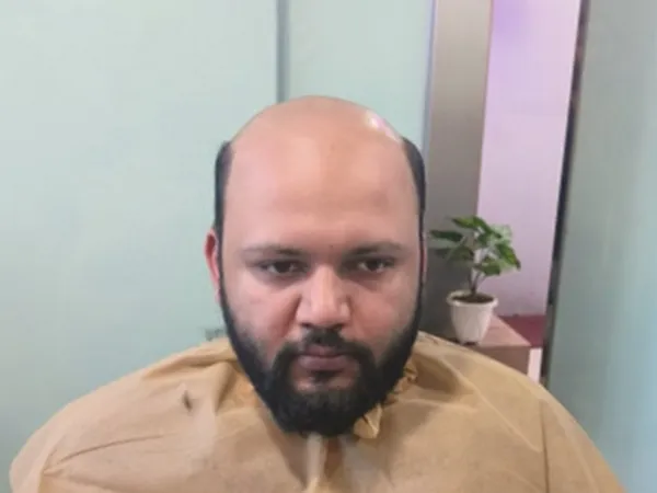 Client-3 - Before