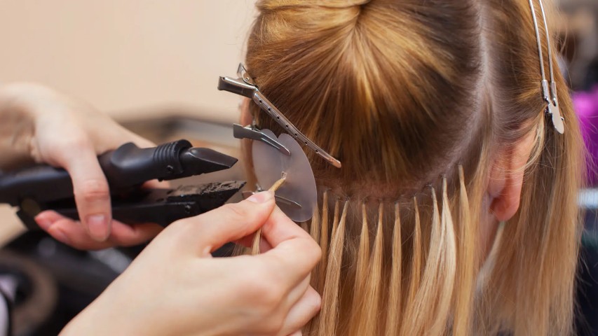 Best Hair Replacement In Delhi | Premium Non-Surgical Solutions